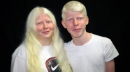 Çukurova&#039;nın albinoları 4 mevsim gölge arıyor