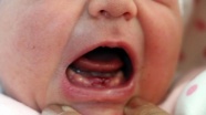 Dokuz dişli bebek dünyaya geldi