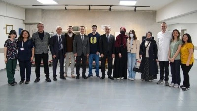 Ege &Uuml;niversitesi Hastanesinde 28 yılda 308 kalp nakli yapıldı
