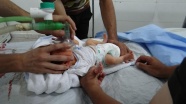 Esed güçleri bebekleri 'klor gazı'yla vurdu
