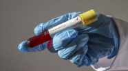 Fildişi Sahili Savunma Bakanı&#39;nın Kovid-19/ koronavirüs testi pozitif çıktı