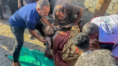 Filistin h&uuml;k&uuml;meti: Gazze'de 20 binden fazla yaralı tedavi bekliyor