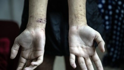 Filistin İnsan Hakları Merkezi: Filistinli esirlere y&ouml;nelik ihlallerde benzeri g&ouml;r&uuml;lmemiş artış var