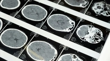 Fransa'da dünyanın en güçlü MRI cihazıyla çekilen insan beyninin en net görüntüsü yayınlandı