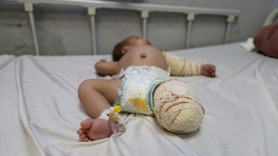 Gazze&rsquo;de annesini emerken vurulan 50 g&uuml;nl&uuml;k Muhammed bebek, annesi ve bacağından sonra elini de kayb