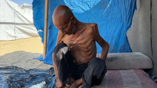 Gazze Şeridi'nde 75 yaşındaki yaşlı adam, İsrail'in dayattığı açlık nedeniyle 40 kiloya dü