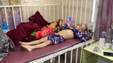 Gazze Şeridi'nde böbrek hastası küçük Meram açlık ve hastalıkla mücadele ediyor