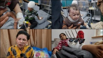 Gazze'de, İsrail'in saldırılarında yaralanan Filistinli çocuklar çektikleri acıyı anlattı