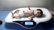 Gıdasızlıktan ölen Suriyeli bebeğin son anları kameraya yansıdı