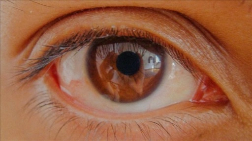 Göz tansiyonunda erken teşhis kalıcı körlüğün önüne geçiyor