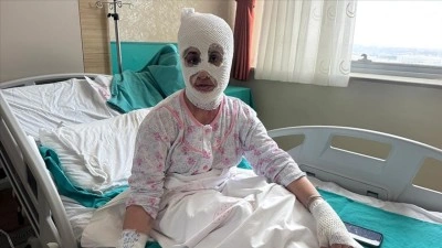 İftara hazırlık sırasında patlayan d&uuml;d&uuml;kl&uuml; tencere iki &ccedil;ocuk annesini hastanelik etti