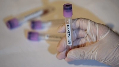 İngiltere, bir İngiliz vatandaşında daha hantavir&uuml;s ş&uuml;phesi tespit edildiğini a&ccedil;ıkladı