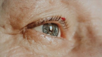 İngiltere'de yapılan ilk yapay kornea nakli 91 yaşındaki hastaya görme yetisini kazandırdı