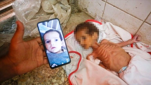 İsrail ablukası altındaki Gazze'de 3 aylık bebek Curi de açlıktan öldü