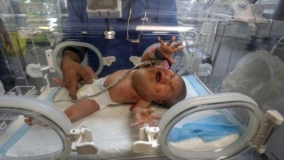 İsrail ablukası altındaki Gazze'de mama krizi, yenidoğanlar i&ccedil;in hayati risk oluşturuyor