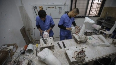İsrail ablukası altındaki Gazze'de protez ve kırık tedavisinde kullanılan malzemeler t&uuml;kenme no