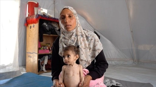 İsrail ablukası altındaki Gazze'de Zekeriyya bebek, yetersiz beslenmeyle mücadele ediyor