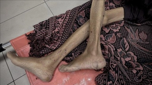 İsrail'in kıtlığı dayattığı Gazze'de 3'ü çocuk 10 kişi daha açlıktan hayatını kaybett