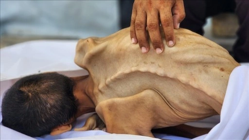 İsrail'in kıtlığı dayattığı Gazze'de günden güne eriyen Adil, açlıktan ölmeden önce 15 kil