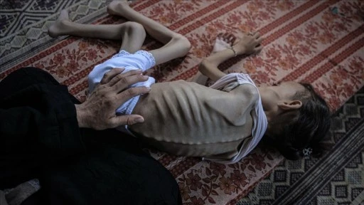 İsrail'in kıtlığı dayattığı Gazze'de son 24 saatte 2'si çocuk 7 Filistinli daha açlıktan öldü