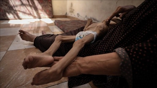 İsrail'in kıtlığı dayattığı Gazze'de son 24 saatte 3 kişi daha açlıktan hayatını kaybetti