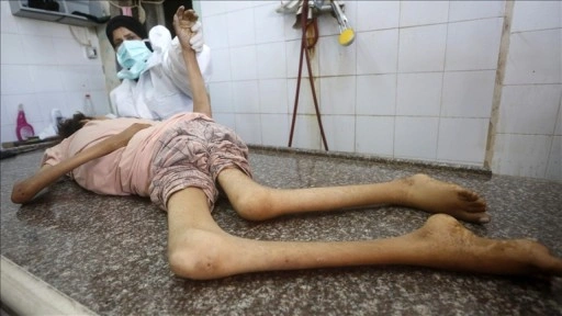 İsrail'in kıtlığı dayattığı Gazze'de son 24 saatte 3'ü çocuk 9 kişi daha açlıktan hay