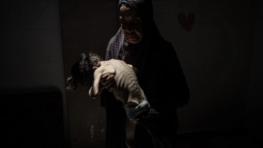 İsrail'in kıtlığı dayattığı Gazze'de son 24 saatte 4 kişi daha açlıktan hayatını kaybetti