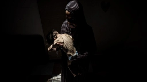 İsrail'in kıtlığı dayattığı Gazze'de son 24 saatte 5 kişi daha açlıktan hayatını kaybetti