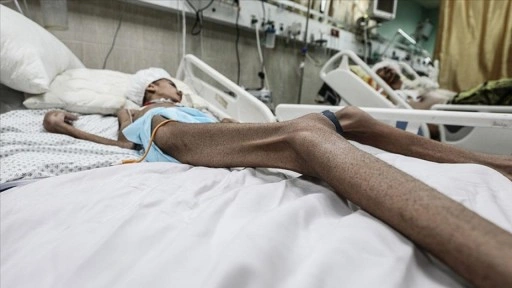 İsrail'in kıtlığı dayattığı Gazze'de son 24 saatte 6 kişi daha açlıktan hayatını kaybetti