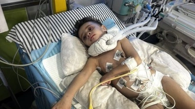 İsrail'in saldırısında yaralanan bebek, Gazze'den &ccedil;ıkışların kısıtlı olması nedeniyle yaşama m&uuml;cadelesinde