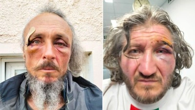 İsrail'in uluslararası sularda K&uuml;resel Sumud Filosu'na saldırısında 31 aktivist yaralandı