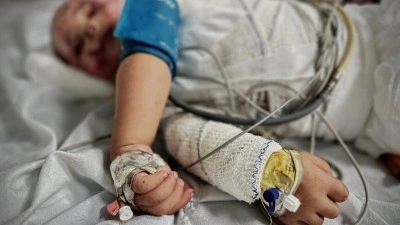 İsrail'in yardım girişlerini kısıtladığı Gazze'de yanık hastaları i&ccedil;in gerekli tıbbi malze