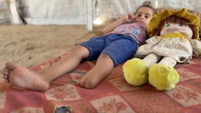İsrail saldırısıyla hayallerini kaybeden Filistinli k&uuml;&ccedil;&uuml;k kız, kopan bacağını fotoğraflarda arıyor
