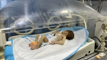 İsrail'in Gazze'de sebep olduğu kıtlığın mağdurlarından Leyla bebek yaşama mücadelesi veriyor