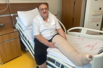 İstanbul'da fil hastasının 2 katına &ccedil;ıkan bacağındaki şişlik tedaviyle geriledi
