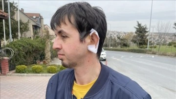 İstanbul'da sahipsiz k&ouml;peklerin saldırdığı kişinin kulağına 20 dikiş atıldı