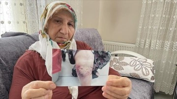 İzmir'de 3 yıl önce köpek saldırısına uğrayan kadın hukuk mücadelesinde kararlı