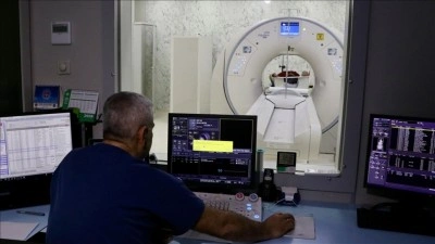 Kalp damarları 10 saniyede g&ouml;r&uuml;nt&uuml;lenerek hastalık teşhisi kolaylaşıyor