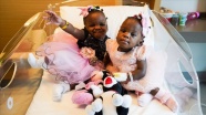 Kamerun'da dünyaya gelen yapışık siyam ikizleri, Türkiye'de şifa buldu