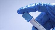 Kanser, Kovid-19/ koronavirüsten ölüm riskini 3 kat artırıyor