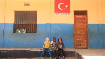 Kara kıtanın 'albino' &ccedil;ocuklarının y&uuml;z&uuml;n&uuml; T&uuml;rk Diyanet Vakfı g&uuml;ld&uuml;rd&uuml;