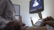 'Karaciğer kanserinde ultrason kullanımı, başarıyı yükseltiyor'