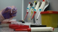 Kovid-19'da hata payını en aza indiren test kiti sağlık çalışanlarına uygulanıyor