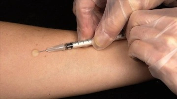Kuduzda "aşı" ve "koruyucu tedbirler" hayat kurtarıyor