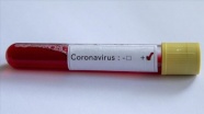 Mısır&#039;da koronavirüs kaynaklı can kaybı 8&#039;e yükseldi