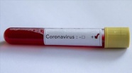 Mısır'da koronavirüs vaka sayısı 55'e yükseldi