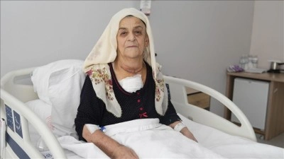 Otuz yıl ertelediği guatr ameliyatında 2 kiloya yakın kitle &ccedil;ıkarıldı