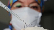Patoloji laboratuvarlarındaki önlemlere “Kovid-19/ koronavirüs“ güncellemesi