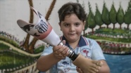 Protez bacağına Santos arması işleyen Suriyeli Hamis&#039;e teşekkür mesajı