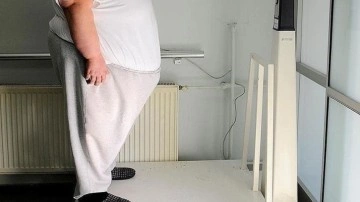Sağlık çalışanlarının obezitelilere ön yargılı yaklaşımı tedavi süreçlerini olumsuz etkiliyor